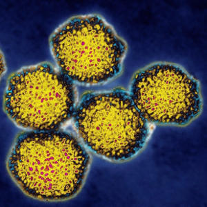 Вирус гепатита А – антитела IgG