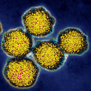 Вирус гепатита С (HCV), ПЦР качественный анализ
