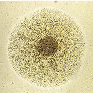 Антитела IgA к микоплазме Mycoplasma hominis