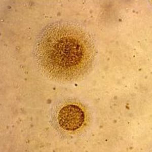 Мікоплазма Mycoplasma hominis, полімеразна ланцюгова реакція (ПЛР)