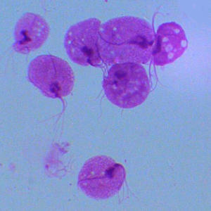 Трихомонада Trichomonas vaginalis, полимеразная цепная реакция (ПЦР)