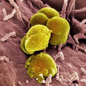 Гонокок Neisseria gonorrhoeae, полімеразна ланцюгова реакція (ПЛР)